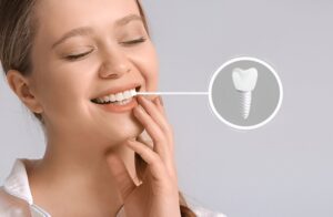 Tooth Implants Edmonton